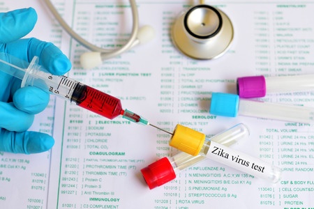 Zika Virus